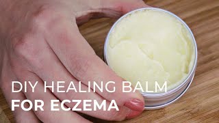 Tutorial for making a Natural Healing Cream for Eczema and Psoriasis [upl. by Haerdna877]