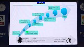 AIOCMTC2 2023 GP28 topic Dr Rahul Kumar Bafna Management a case of acute corneal hydrop [upl. by Anneres]