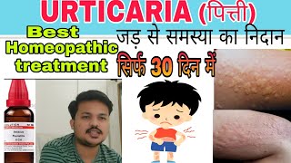 URTICARIAपित्ती Best homeopathic medicine for urticaria खुजली को कहो अलविदा urticaria treatment [upl. by Carmine]