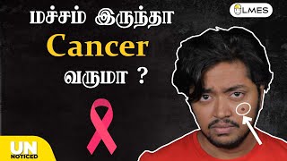 மச்சம் இருந்தா Cancer வருமா  Tamil  LMES  unnoticed [upl. by Lucy]