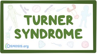 Turner syndrome Year of the Zebra [upl. by Nerahs]