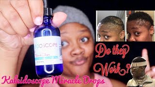 Kaleidoscope Miracle Drops Review Do They Really Work 3 Months Update [upl. by Mook]