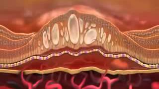 Lucentis ranibizumab [upl. by Russ]