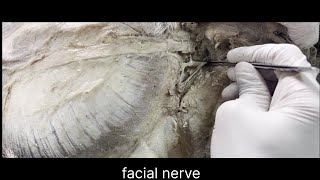 Facial nerve anatomy [upl. by Korwin]