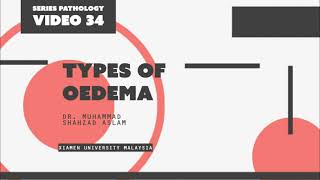 Type of Oedema  YouTube Journal Club Learning PathologyV34 [upl. by Dranel298]