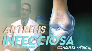 ¿Qué es la artritis infecciosa  Síntomas y Tratamiento [upl. by Paradies]