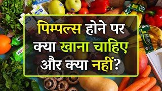 पिम्पल्स को दूर करने के लिए क्या खाना चाहिए और क्या नहीं  Effective Diet for Pimples in Hindi [upl. by Eisseb685]