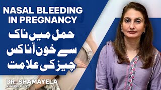 Nasal Bleeding In Pregnancy is it normal How To Stop Bleeding Nose  Shamayela Hanif  Gynecologist [upl. by Kalin]