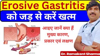 Erosive Gastritis A Comprehensive Guide to Causes Symptoms and Treatmentdrramakantsharma7 [upl. by Zacharias993]