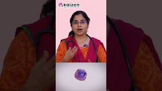 Does platelet count decrease in blood cancer  DrByreddy Poojitha bloodcancer plateletrichplasma [upl. by Clarinda]