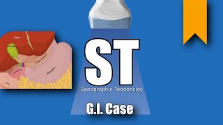 Cases GI Duodenal Duplication Cyst [upl. by Aleedis743]