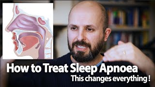 How to Treat Sleep Apnoea  This Changes Everything [upl. by Goldston]