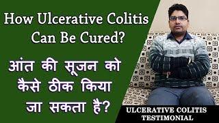 How Ulcerative colitis can be Cured  अल्सरेटिव कोलाइटिस को कैसे ठीक किया जा सकता है [upl. by Gaylord]