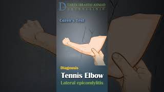 cozens test for tennis elbow  lateral epicondylitis [upl. by Garner]