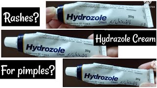 Hydrozole Cream review [upl. by Rosenblatt]