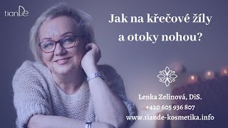 Jak na křečové žíly a otoky nohou [upl. by Octave882]