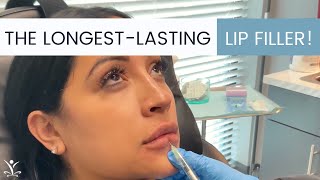 Volbella Lip Injections Can Last Up to a Whole Year [upl. by Noreht]