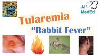 Tularemia Rabbit Fever  Causes Pathogenesis Forms Symptoms Diagnosis Treatment [upl. by Srini834]