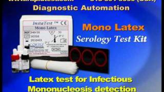 Mono Infectious Mononucleosis Serology kit [upl. by Ailic416]