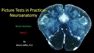 Picture Test in Neuroanatomy Brain Sections 1 [upl. by Ttergram172]