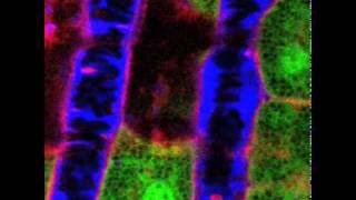 NIDCR Liver Vascular Flow [upl. by Arikal]