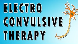 Electroconvulsive Therapy [upl. by Slavic]