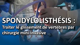 Le spondylolisthésis  traiter le glissement de vertèbres par chirurgie miniinvasive [upl. by Anaeirb]