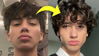 How to remove face fat [upl. by Byler]