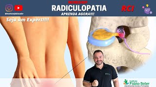 COMO TRATAR A RADICULOPATIA COM TRATAMENTO COMPLETO EM RCI [upl. by Ynneg]