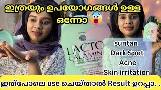 Lacto calamine ഇത്ര uses ഉണ്ടായിരുന്നോ 🫢ഇങ്ങനെ use ചെയ്തു നോക്കൂ  Lacto Calamine how to use [upl. by Enigroeg]