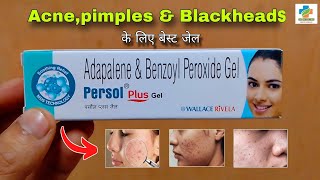 Persol Plus Gel Use in Hindi  Acnepimples Blackhead  Adapalene amp Benzoyl peroxide SK MEDICINE [upl. by Nichani]