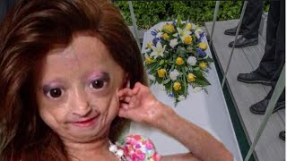 RIP Youtuber Adalia Rose Died Last Moment With her Mother😭This is so sd [upl. by Stetson157]