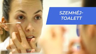 Semmelweis oktatóvideók Szemhéjtoalett [upl. by Aiekram]