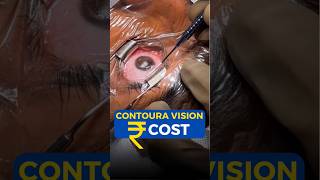 Contoura Vision Cost [upl. by Ahtelat]