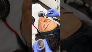 Enhance your chemical peels [upl. by Dray]