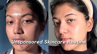 How I got rid of my ACNE SCARS amp TEXTURE  My Unsponsored Skincare Routine 🧴🫧🧖 [upl. by Lola]