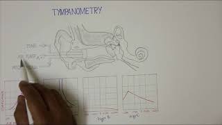 TYMPANOMETRY [upl. by Vincenta]