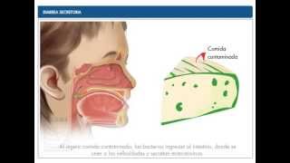 Diarrea Secretoria [upl. by Alitha]