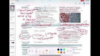 Systematic amyloidosis Pathology 21  First Aid USMLE Step 1 in UrduHindi [upl. by Ehcsrop23]