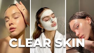 How to REMOVE acne [upl. by December]