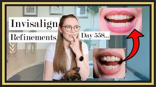 Invisalign Refinements Update 18 months later  Cracked Tray Stained Tooth Gums amp Bite [upl. by Allegna]