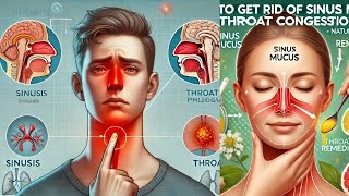 4 Surprising Home Remedies for Sinusitis You Wont Find Anywhere Else [upl. by Attiuqram201]