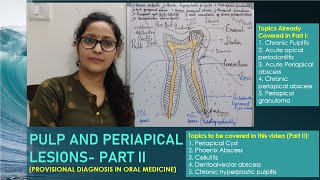 Pulp and Periapical Infections Part II in Hindil Chairside Diagnosis [upl. by Enoek978]