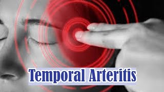 Temporal Arteritis  Giant Cell Arteritis  Symptoms Causes Complications and Treatment [upl. by Nil]