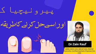 What is PARONYCHIA Its a nail infection  Solve Paronychia  In Urdu [upl. by Ardnal]