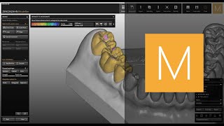 Prettau® Fully Anatomic software module of ZirkonzahnModellier  ZirkonzahnSoftware [upl. by Akcirehs]