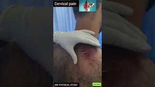 Cervical pain doctor physio shoulderinjury shoulderpain aiims viralreels rehabilitation [upl. by Sumaes]