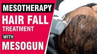 Mesotherapy Hair Fall Treatment With Mesogun  Procedure Video  Sakhiya Skin Clinic [upl. by Harpole135]