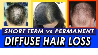 Permanent vs Temporary Diffuse Hair Loss and Telogen Effluvium How to differentiate [upl. by Aikenahs68]