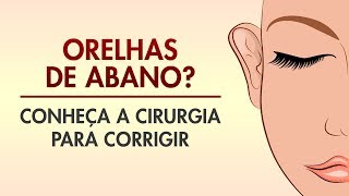 OTOPLASTIA ORELHA DE ABANO COMO É FEITA DREAM PLASTIC  CIRURGIA PLÁSTICA [upl. by Mata]